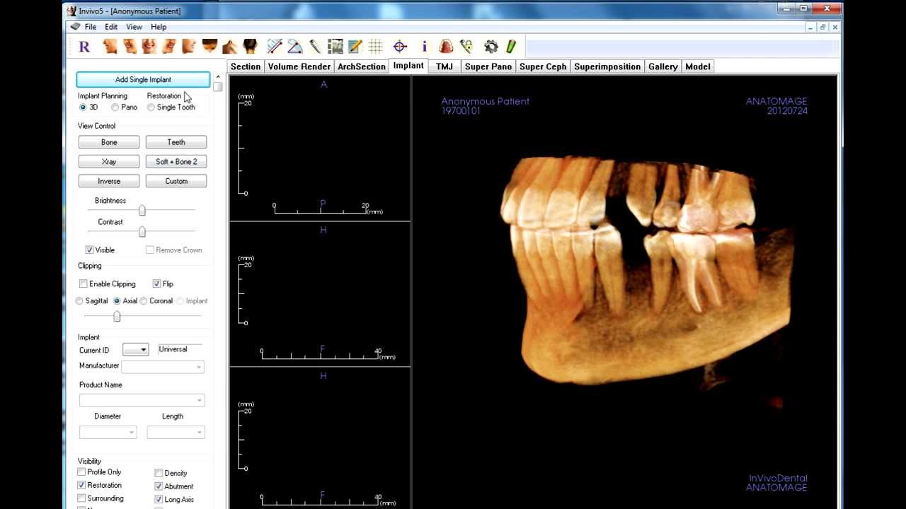 Anatomage In Vivo Viewer